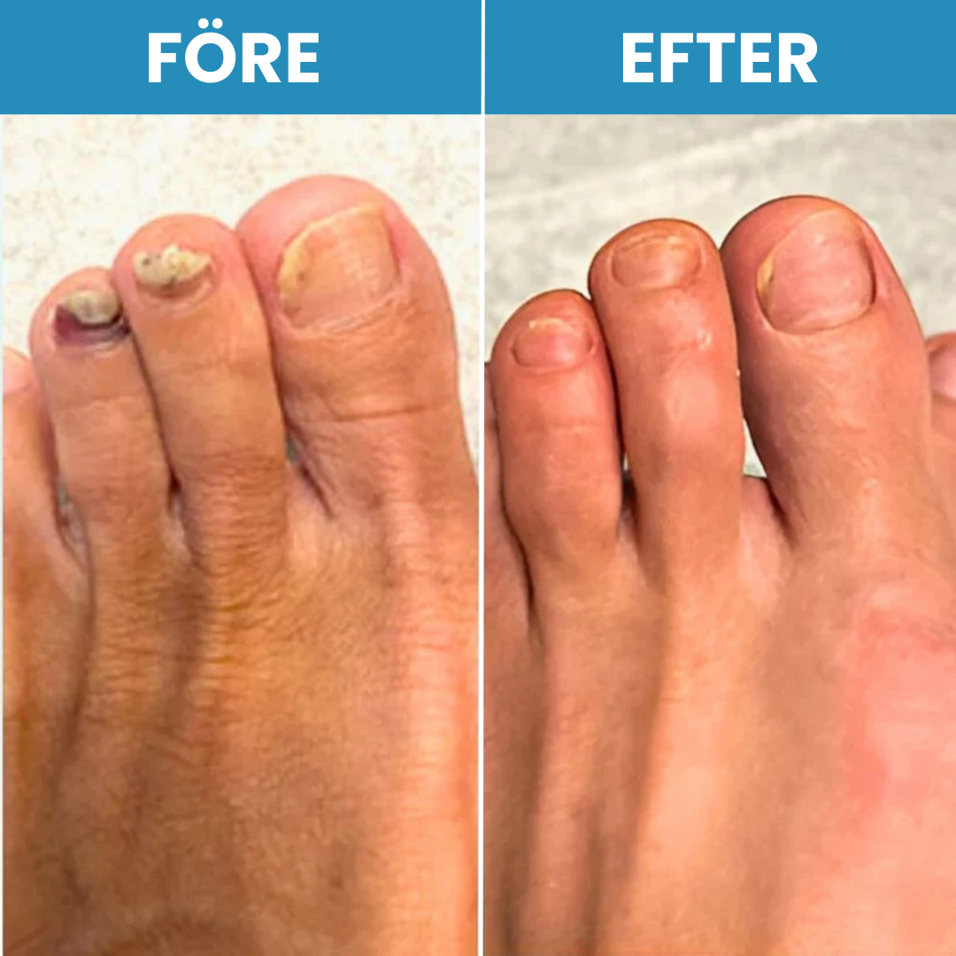 NailRenew
