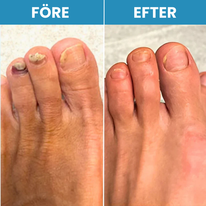 NailRenew